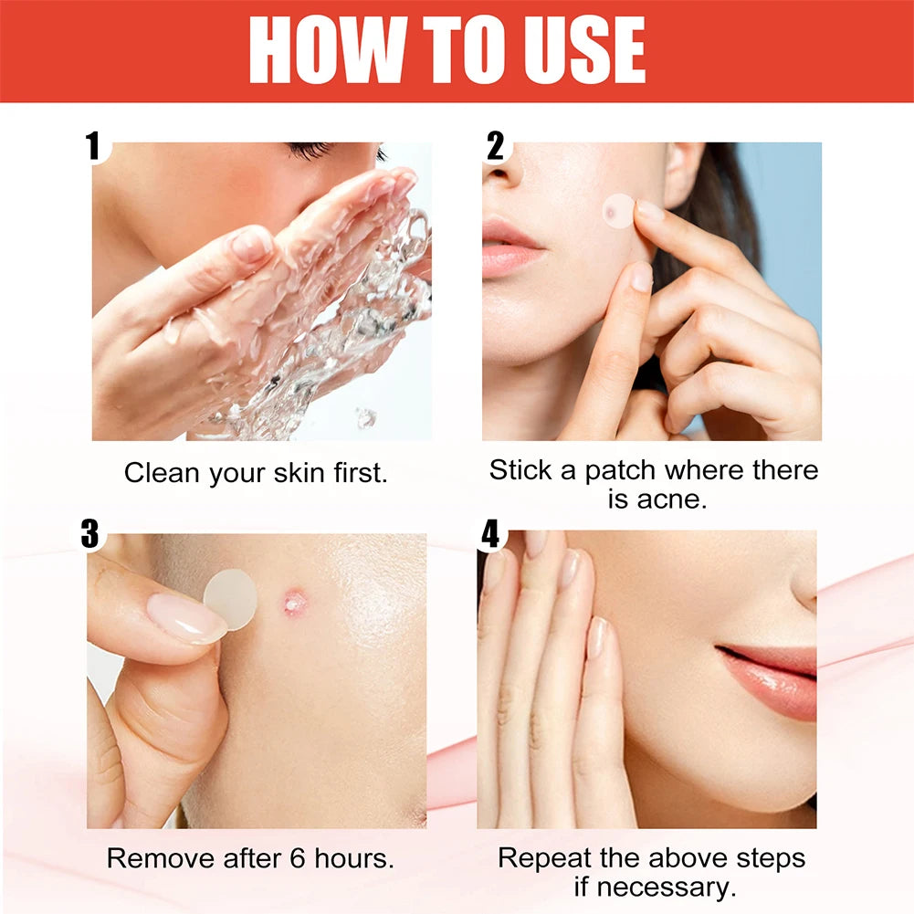 Pimple Patch set