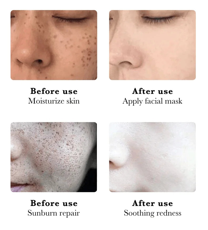 Whitening Freckles Face Cream